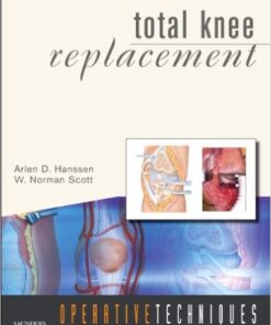 Operative Techniques: Total Knee Replacement 1e