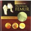Fractures of the Proximal Femur: Improving Outcomes1e 1st Edition