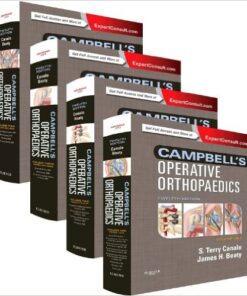 Campbell's Operative Orthopaedics: 4-Volume Set, 12e 12th Edition