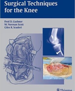 Surgical Techniques for the Knee