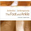 Arthritis and Arthroplasty: The Foot and Ankle: Expert Consult  1e