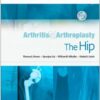 Arthritis and Arthroplasty: The Hip: Expert Consult 1e