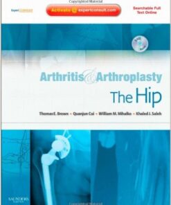 Arthritis and Arthroplasty: The Hip: Expert Consult 1e