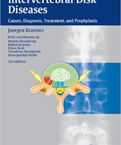 Intervertebral Disk Diseases: Causes, Diagnosis, Treatment and Prophylaxis Kindle Edition
