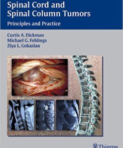 Spinal Cord and Spinal Column Tumors: Principles and Practice 1st Edition