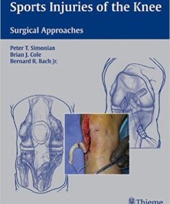 Sports Injuries of the Knee: Surgical Approaches