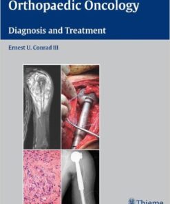 Orthopaedic Oncology: Diagnosis and Treatment