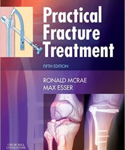 Practical Fracture Treatment, 5e 5th Edition