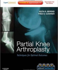 Partial Knee Arthroplasty: Techniques for Optimal Outcomes 1e