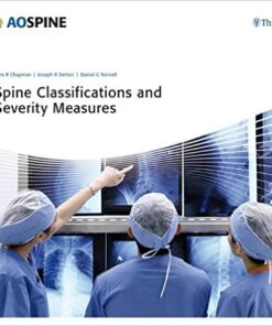 Spine Classifications and Severity Measures 1st Edition