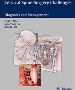 Cervical Spine Surgery Challenges: Diagnosis and Management 1st Edition