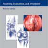 Posterolateral Knee Injuries: Anatomy, Evaluation, and Treatment 1st Edition