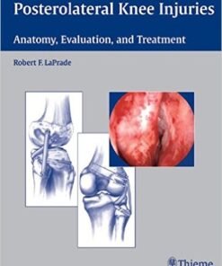 Posterolateral Knee Injuries: Anatomy, Evaluation, and Treatment 1st Edition