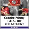 Complex Primary Total Hip Replacement 1st Edition