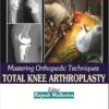 Mastering Orthopedic Techniques Total Knee Arthroplasty 1st Edition