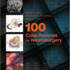 100 Case Reviews in Neurosurgery, 1e