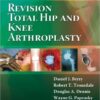 Revision Total Hip and Knee Arthroplasty 1st Edition