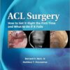 ACL Surgery: How To Get It Right the First Time and What To Do if it Fails 1st Edition