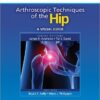 Arthroscopic Techniques of the Hip: A Visual Guide (Visual Arthroscopy) 1st Edition