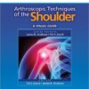 Arthrscopic Techniques of the Shoulder: A Visual Guide (Visual Arthroscopy) 1st Edition