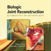 Biologic Joint Reconstruction: Alternatives to Joint Arthroplasty 1st Edition