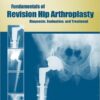 Fundamentals of Revision Hip Arthroplasty: Diagnosis, Evaluation, and Treatment 1st Edition