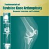 Fundamentals of Revision Knee Arthroplasty: Diagnosis, Evaluation, and Treatment 1st Edition