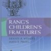 Rang's Children's Fractures Third Edition