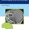 Differential Diagnosis in Neuroimaging: Brain and Meninges 1st Edition   PDF ORIGINAL
