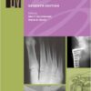 Manual of Orthopaedics, 7e (Lippincott Manual) Seventh Edition