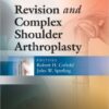 Revision and Complex Shoulder Arthroplasty 1st Edition