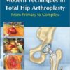 Modern Techniques in Total Hip Arthroplasty: From Primary to Complex 1st Edition