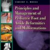 Principles and Management of Pediatric Foot and Ankle Deformities and Malformations First Edition