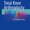Total Knee Arthroplasty: A Comprehensive Guide 1st ed. 2015 Edition