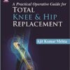 A Practical Operative Guide for Total Knee and Hip Replacement 2nd Edition