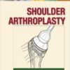 Shoulder Arthroplasty Kindle Edition
