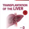 Transplantation of the Liver, 3e 3rd Edition