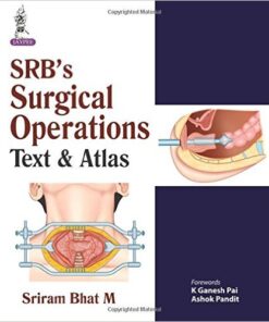 Srb's Surgical Operations 1st Edition