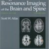 Magnetic Resonance Imaging of the Brain and Spine (2 Volume Set) Fourth Edition