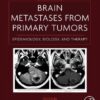 Brain Metastases from Primary Tumors. Epidemiology, Biology, and Therapy Volume 1