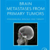 Brain Metastases from Primary Tumors, Volume 2: Epidemiology, Biology, and Therapy 1st Edition