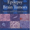Epilepsy and Brain Tumors 1st Edition
