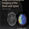 Magnetic Resonance Imaging of the Brain and Spine Fifth Edition PDF