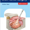 Getting Ready for Brain Tumor Surgery 1st Edition PDF ORIGINAL