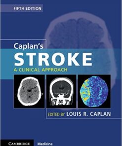 Caplan's Stroke: A Clinical Approach 5th Edition