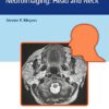 Differential Diagnosis in Neuroimaging: Head and Neck 1st Edition