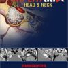 EXPERTddx: Head and Neck: Published by Amirsys® (EXPERTddx (TM))