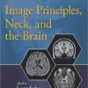 Image Principles, Neck, and the Brain (Magnetic Resonance Imaging Handbook) (Volume 1) 1st Edition