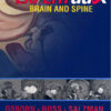 Expertddx: Brain and Spine 1st Edition PDF ORIGINAL