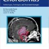 Chordomas: Technologies, Techniques, and Treatment Strategies 1st Edition PDF